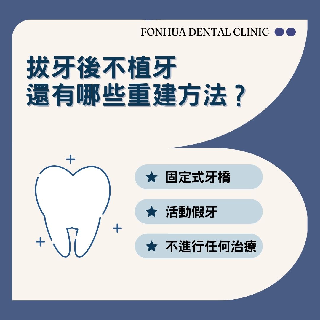 拔牙後不植牙，還有哪些重建方法？